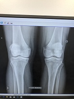 Click image for larger version  Name:	9A920DD6-F698-47D1-BD7A-86479DA14185.jpeg Views:	1 Size:	2.62 MB ID:	117122