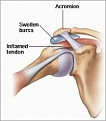 Click image for larger version

Name:	54cb9ae08fa3704d0cbe245166cb5976--shoulder-injuries-health-care.jpg
Views:	1076
Size:	8.8 KB
ID:	91388